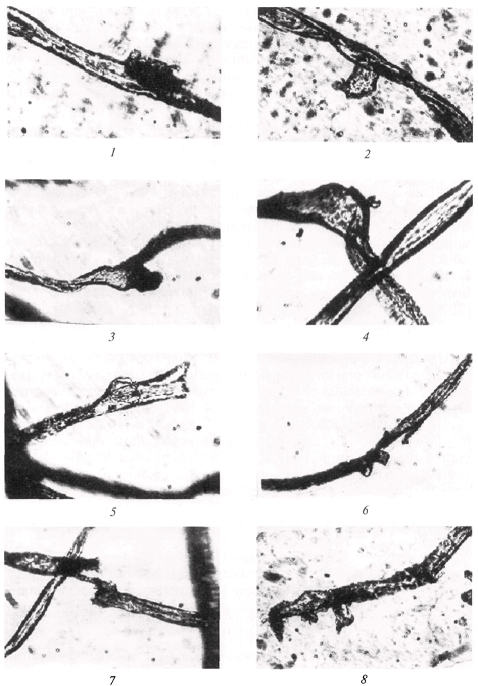 . 22.      (   ): 1 -   ; 2 -  ; 3, 4 - ; 5, 6 -  ; 7, 8 -   (× 400)