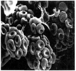 . 10.  Trichoderma (× 3000)