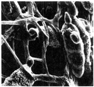 . 11.  Alternaria (× 600)